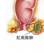 福州治肛周红肿去哪个医院好