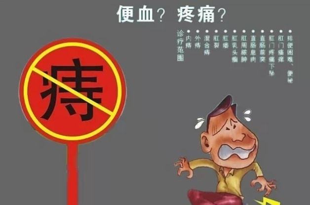 福州治痔疮去哪家医院好